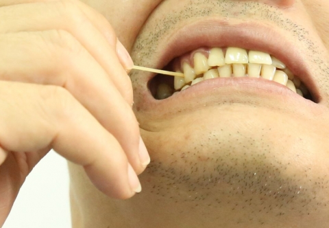 Tăm xỉa răng - Lợi ích mong manh và hệ lụy khó lường